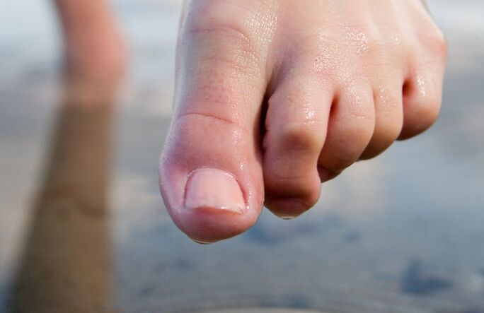 Wet feet encourage the spread of fungi